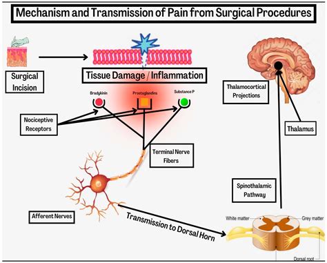 Multimodal Pain Management in Orthopedic Surgery