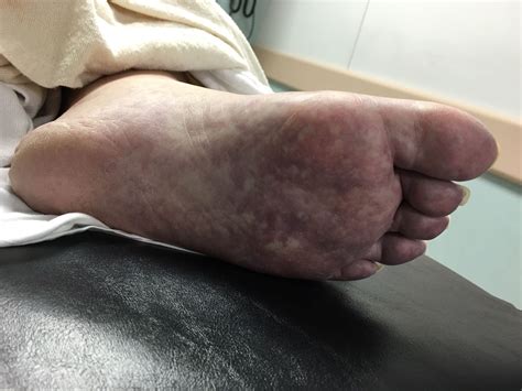 UMEM Educational Pearls - University of Maryland School of Medicine ...