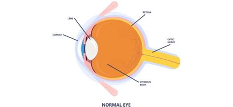 Image result for Eye Floaters Under Microscope