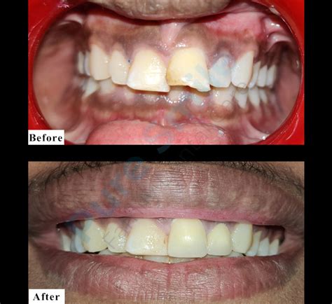 Pure Smile Family Dental Care | Dr. Roshni Bhatt | Dr. Dharti Bhatt ...