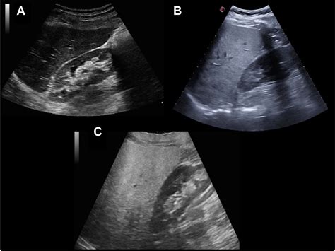 Point-of-Care Ultrasound in Clinical Care - Medical Clinics