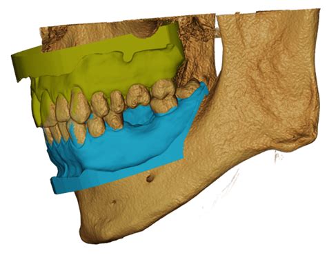 Image result for Atomica Software Arabic Tutorial