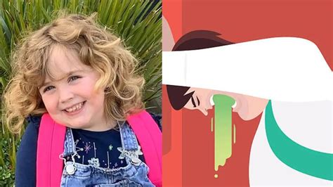 Girl Dies from Rare Post-Tonsil Surgery Complication; What Is Cyclical ...
