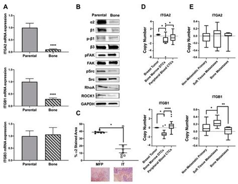 Biphasic α2β1 and Breast Cancer | Encyclopedia MDPI