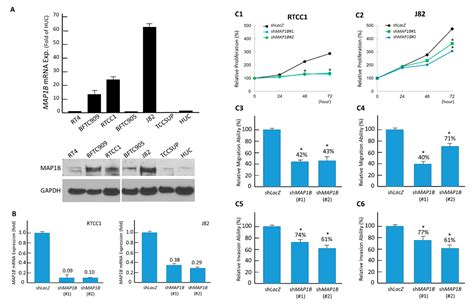 Role of Microtubule-Associated Protein 1b in Urothelial Carcinoma ...