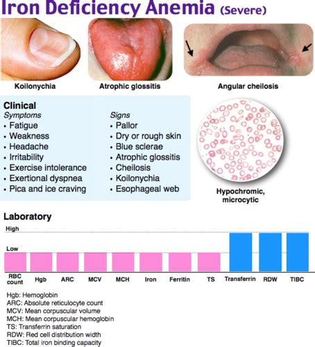 Clin Med - Anemias Flashcards | Quizlet