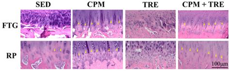 Can Early Rehabilitation Prevent Posttraumatic Osteoarthritis in the ...