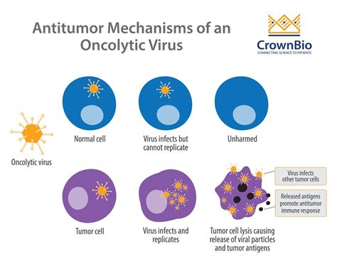 Oncolytic Viruses in Cancer Therapy