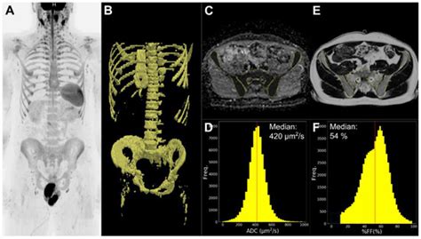 Diagnostics | Special Issue : Whole Body MRI: Major Advances and Future ...