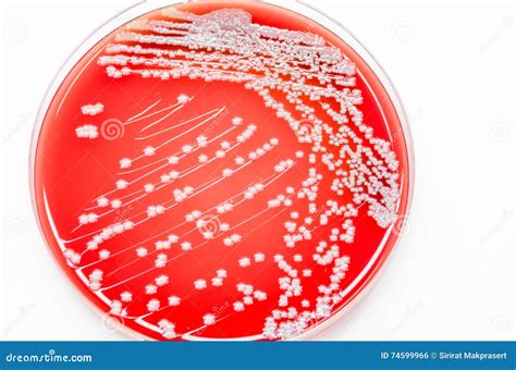Bacterial Culture Growth on Blood Agar Media (Staphylococcus Aureus ...