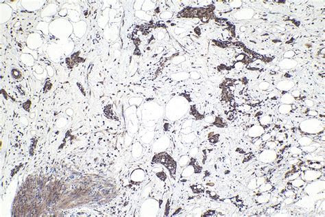 IHCeasy MAPK7 Ready-To-Use IHC Kit KHC1704 | Proteintech