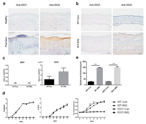 Indoleamine 2,3-Dioxygenase 2 Deficiency Exacerbates Imiquimod-Induced ...