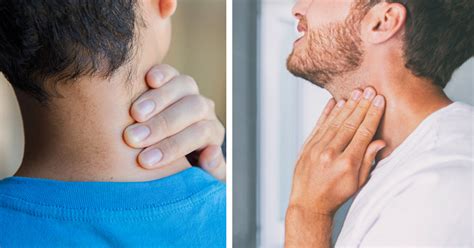 What Causes Dark Neck & How To Get Rid Of It