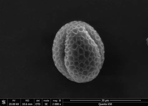 Image result for Flower Pollen Under Microscope