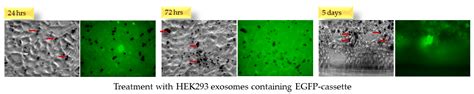 3′-UTR Sequence of Exosomal NANOGP8 DNA as an Extracellular Vesicle ...