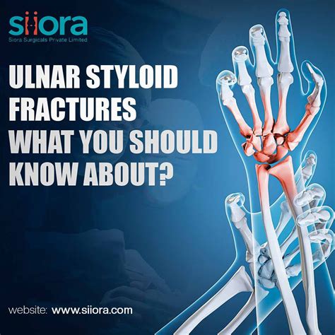 Ulnar Styloid Pain