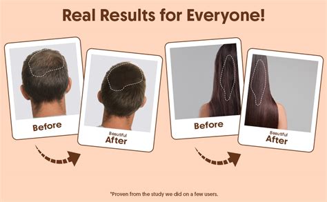Buy Aravi Organic 100% Pure Cold Pressed Almond Oil - For Hair Growth ...