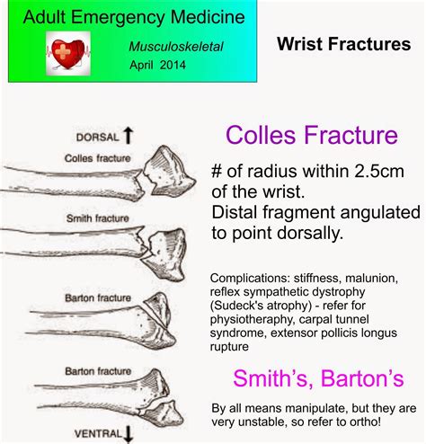Musculoskeletal Emergency Medicine: The Radius