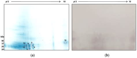 Immunoblotting Identification of Diagnostic Antigens of Paragonimus ...