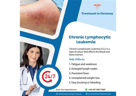 Chronic Lymphocytic Leukemia treatment and stages | PDF