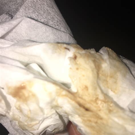 Why Is My Discharge Brown