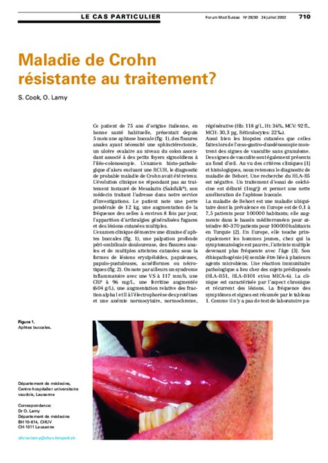 Image result for Contesting Development