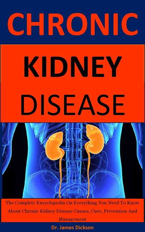Buy Chronic Kidney Disease: The Complete Encyclopedia On Everything You ...