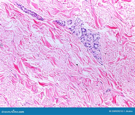 Dense Irregular Connective Tissue Skin