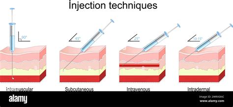 Intramuscular Injection Needle 的图像结果