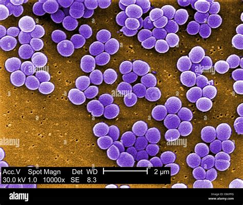 Staphylococcus Aureus Under Microscope 的图像结果