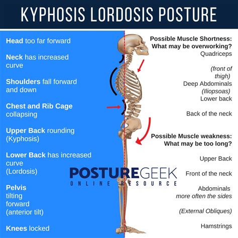 Kyphosis Lordosis Exercises Physical Therapy And Chiropractic Care