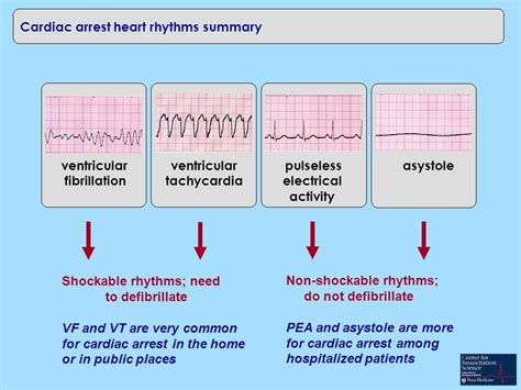 shockable and non shockable rhythms - Charles Vance