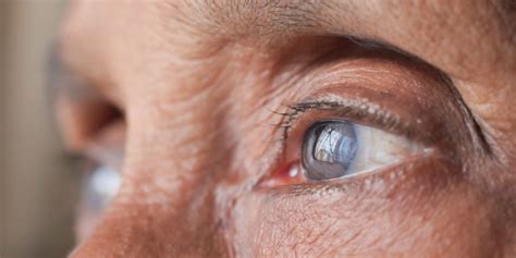 Image result for Distorted Vision Examples