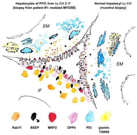 Advanced Microscopy for Liver and Gut Ultrastructural Pathology in ...