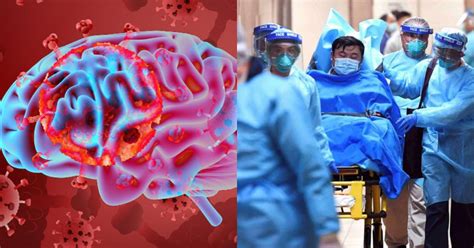 Scientists Claim That COVID-19 Can Affect The Central Nervous System ...