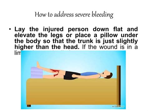 Image result for Bleeding First Aid