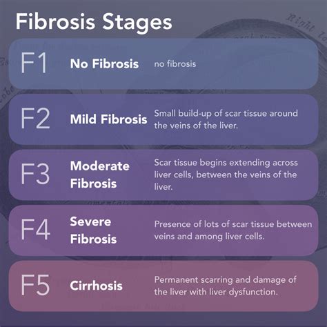 3 Charts | What is NASH Fibrosis? | A Visual Guide