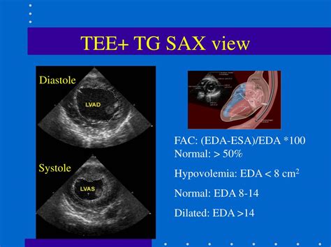 SvO2 的图像结果