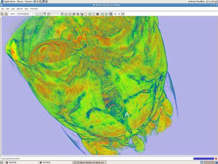 Image result for Python Volume Slicer