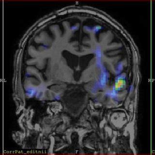 Image result for fMRI Python