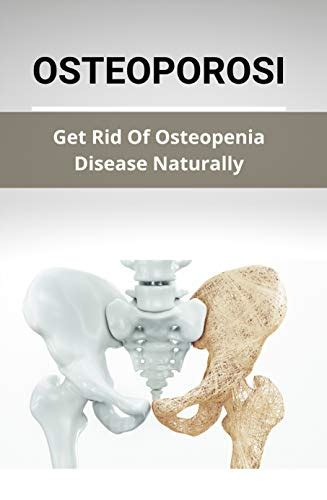 Osteoporosis: Get Rid Of Osteopenia Disease Naturally: Is Useful For ...