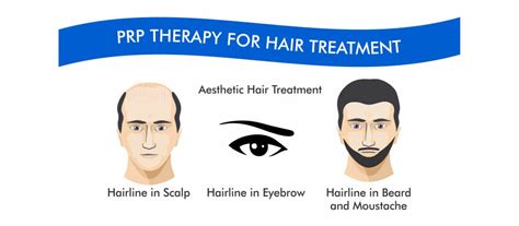 PRP-Platelet Rich Plasma | Regain Hair Clinic