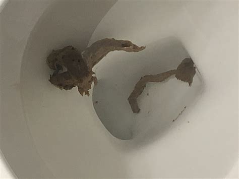 Colon Cancer Stool