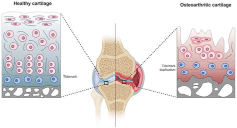 Human Cartilage Biomechanics: Experimental and Theoretical Approaches ...