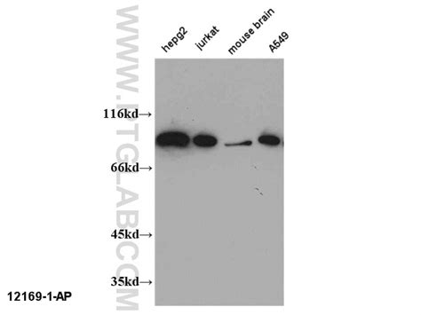 CHFR antibody (12169-1-AP) | Proteintech