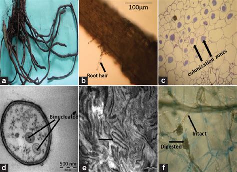 Study of morphology and orchid mycorrhizal associations in Malaxis rheedei