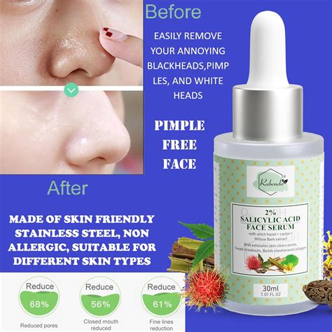 Justdun | Rabenda Face Serum With Salicylic Acid For Oily & Acne-Prone ...