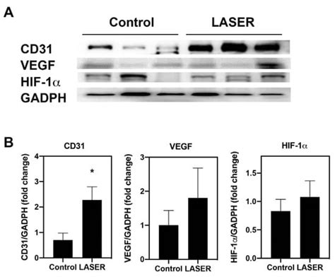 Low-Level Laser Therapy Induces Melanoma Tumor Growth by Promoting ...