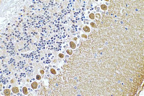 RGS8 antibody (27394-1-AP) | Proteintech