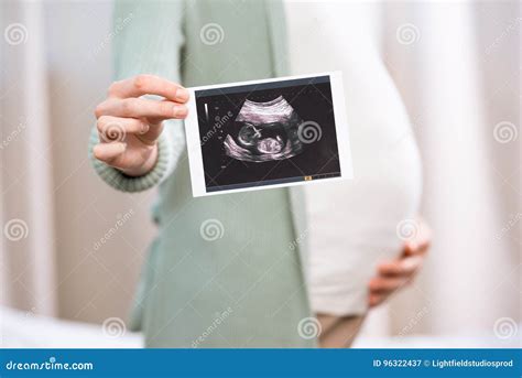 Pregnant Woman Holding Ultrasound Scan of Baby and Touching Belly Stock ...